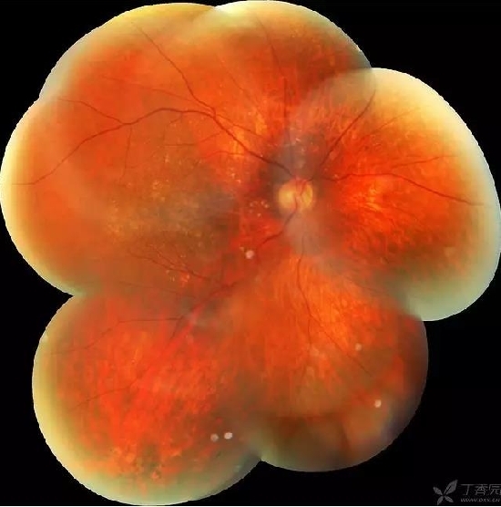 �����������۵ײ���ͼƬ