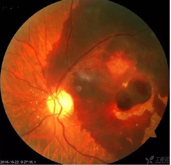 �����������۵ײ���ͼƬ