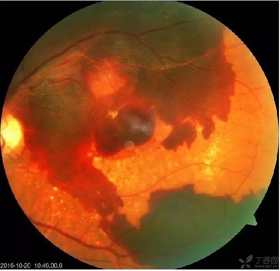 �����������۵ײ���ͼƬ