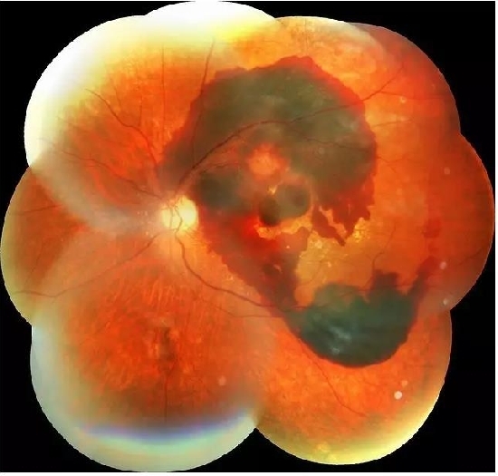 �����������۵ײ���ͼƬ