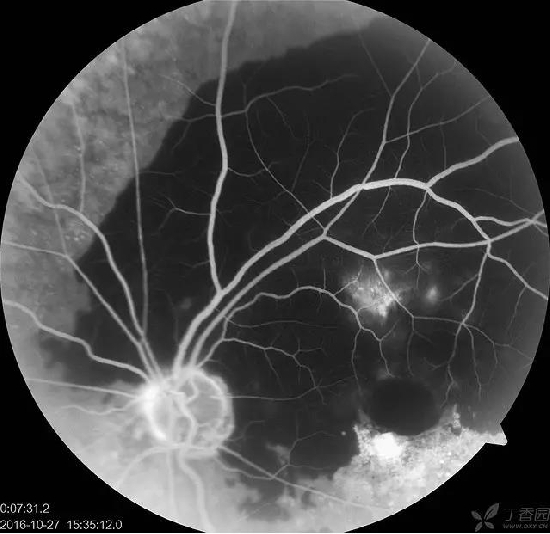 �����������۵ײ���ͼƬ