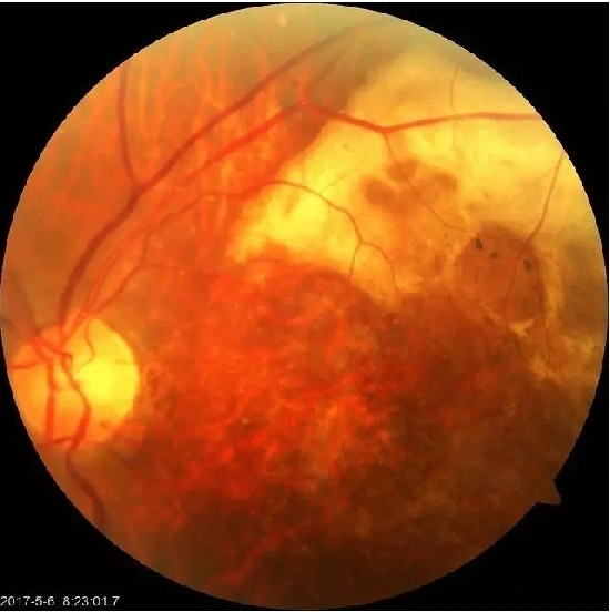 �����������۵ײ���ͼƬ