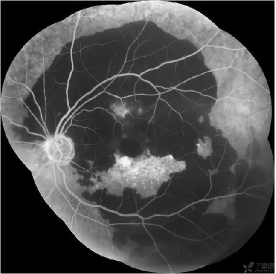 �����������۵ײ���ͼƬ