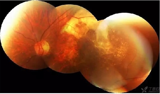 �����������۵ײ���ͼƬ