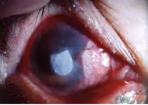 ŷ����׼�׸���Ӫ���Խ�Ĥ������ҩ��