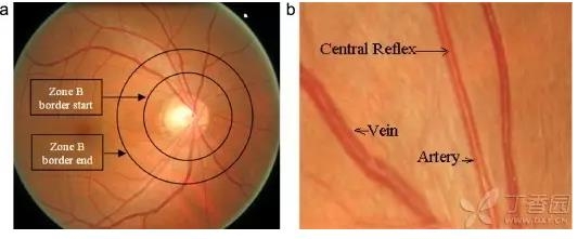 ����Ĥ���֪ʶѧϰ������ͼƬ����