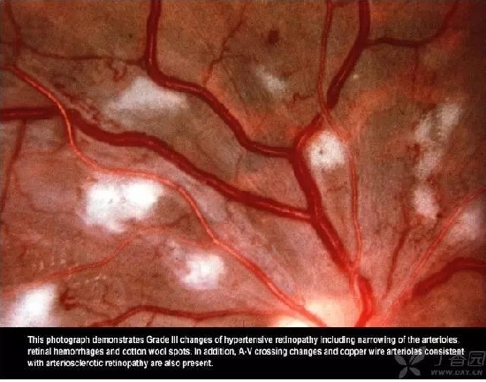 ����Ĥ���֪ʶѧϰ������ͼƬ����