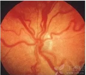 ����Ĥ���֪ʶѧϰ������ͼƬ����