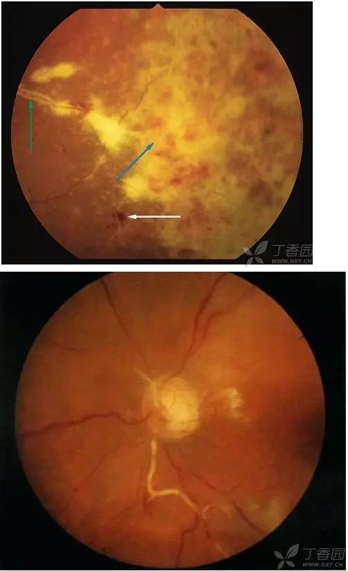 ����Ĥ���֪ʶѧϰ������ͼƬ����