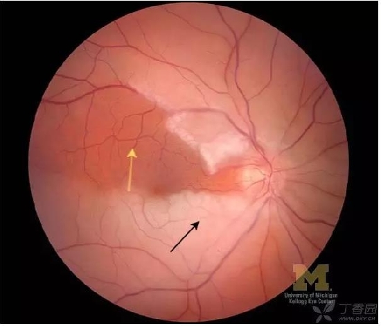 ����Ĥ���֪ʶѧϰ������ͼƬ����