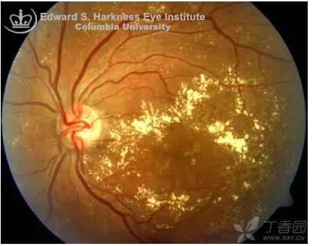 ����Ĥ���֪ʶѧϰ������ͼƬ����