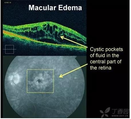 ����Ĥ���֪ʶѧϰ������ͼƬ����