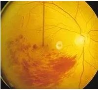 ����Ĥ���֪ʶѧϰ������ͼƬ����