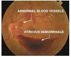 ����Ĥ���֪ʶѧϰ������ͼƬ����