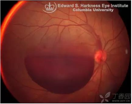 ����Ĥ���֪ʶѧϰ������ͼƬ����