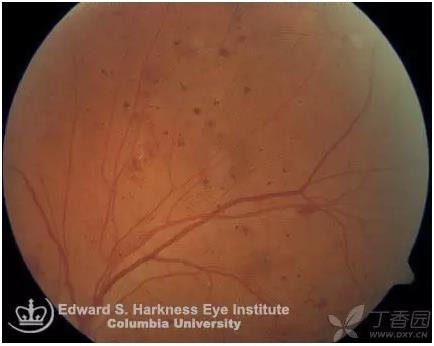 ����Ĥ���֪ʶѧϰ������ͼƬ����