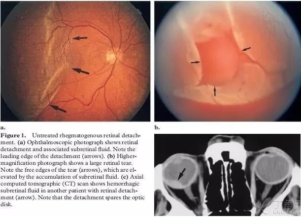 ����Ĥ���֪ʶѧϰ������ͼƬ����