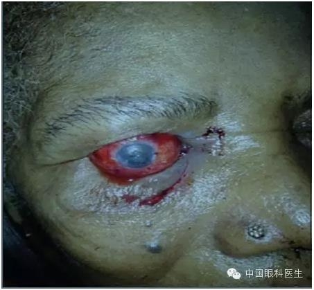 ��������������λ���ָ�λ 1 ��