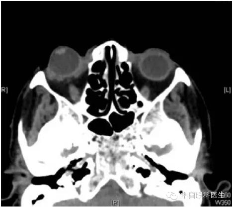 ��������������λ���ָ�λ 1 ��