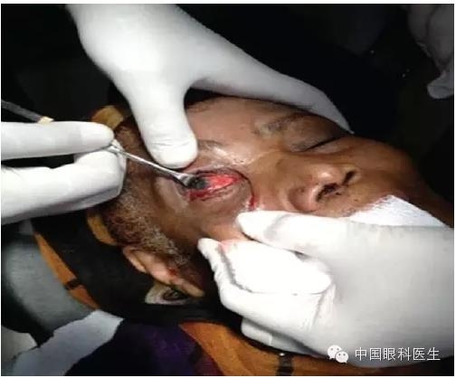 ��������������λ���ָ�λ 1 ��