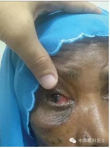 ��������������λ���ָ�λ 1 ��