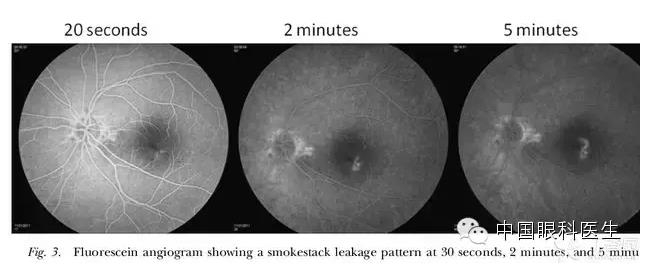 CSC-�н��Ĺ�ȥ���ں�δ������ǿ�ܽᣬ�ղر��ã�