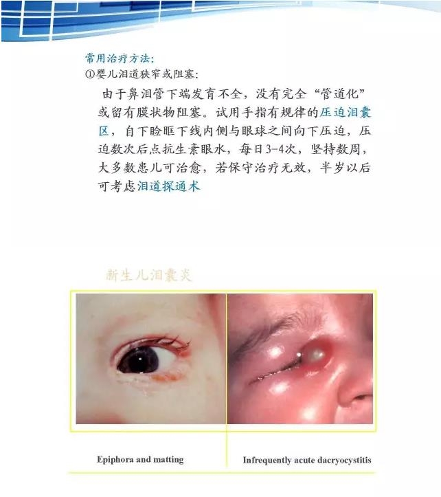 ���������۱�����