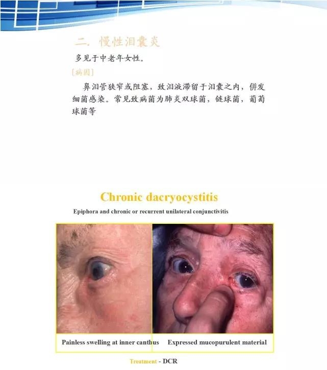 ���������۱�����