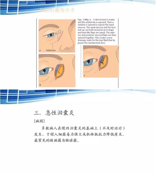 ���������۱�����