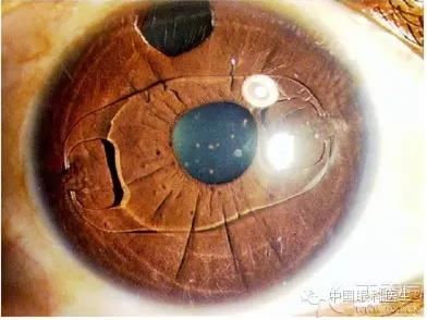 �����ۿ�ҽ����Ҫ�˽���˹�����