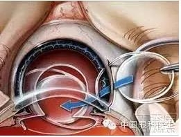 �����ۿ�ҽ����Ҫ�˽���˹�����