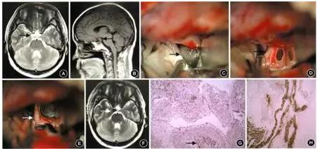 ����������������Ĥ����һ��