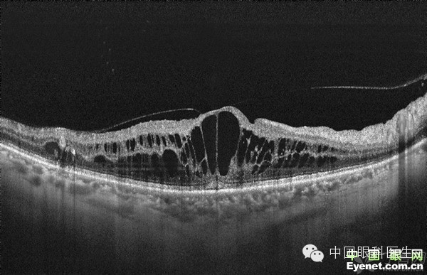 ��������Ĥ��������ۡ���ȫͼ�������ղء�