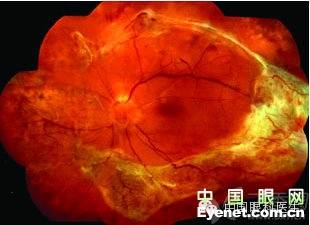 ��������Ĥ��������ۡ���ȫͼ�������ղء�