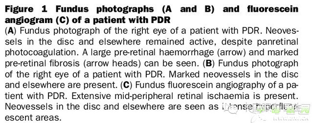 ��������Ĥ��������ۡ���ȫͼ�������ղء�