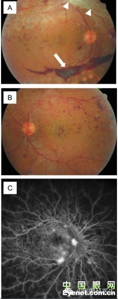 ��������Ĥ��������ۡ���ȫͼ�������ղء�