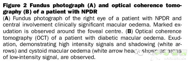 ��������Ĥ��������ۡ���ȫͼ�������ղء�