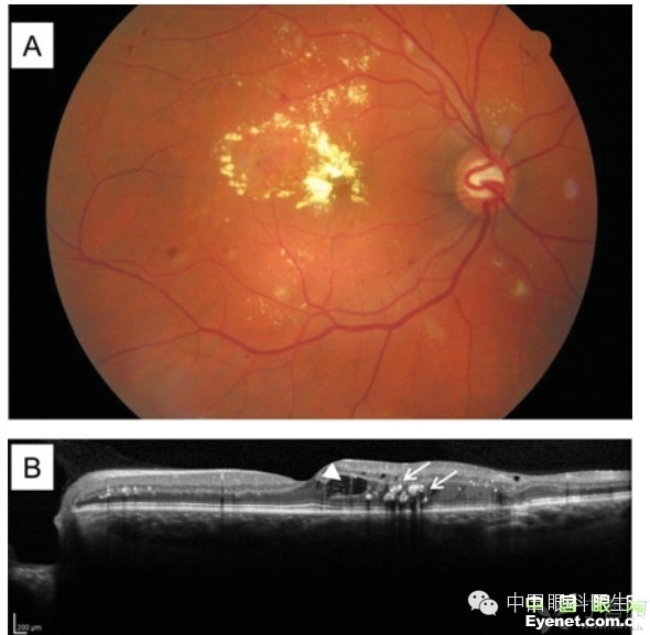 ��������Ĥ��������ۡ���ȫͼ�������ղء�