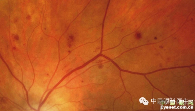 ��������Ĥ��������ۡ���ȫͼ�������ղء�