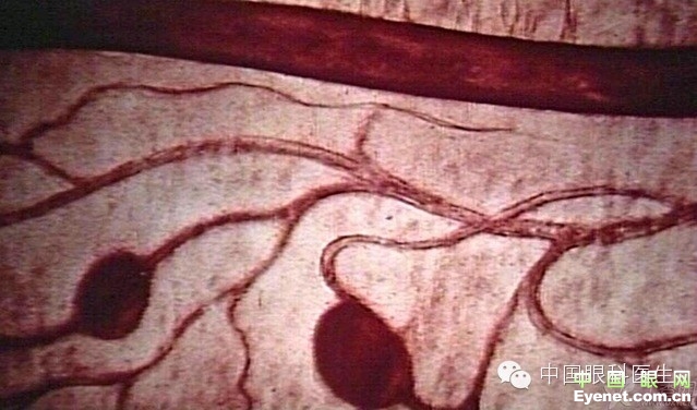 ��������Ĥ��������ۡ���ȫͼ�������ղء�