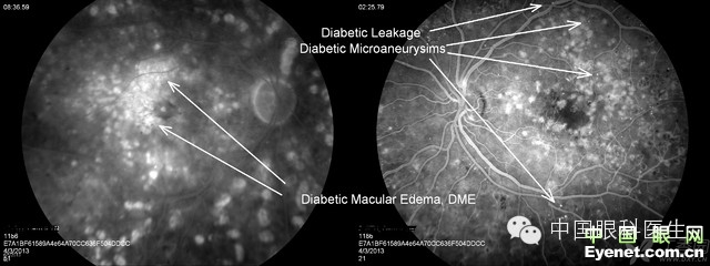 ��������Ĥ��������ۡ���ȫͼ�������ղء�