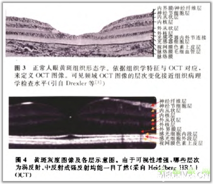 �ۿ�̩�����������OCT���ͼ��ɼ�������������ǳ�ֵ���ղأ�