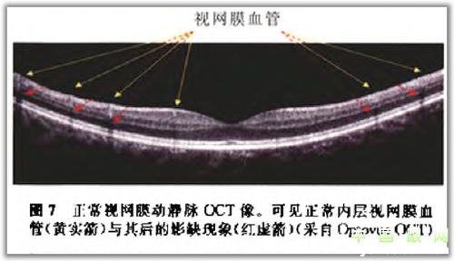 �ۿ�̩�����������OCT���ͼ��ɼ�������������ǳ�ֵ���ղأ�