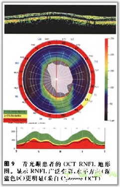 �ۿ�̩�����������OCT���ͼ��ɼ�������������ǳ�ֵ���ղأ�