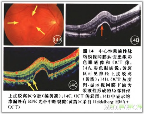 �ۿ�̩�����������OCT���ͼ��ɼ�������������ǳ�ֵ���ղأ�