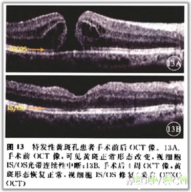 �ۿ�̩�����������OCT���ͼ��ɼ�������������ǳ�ֵ���ղأ�