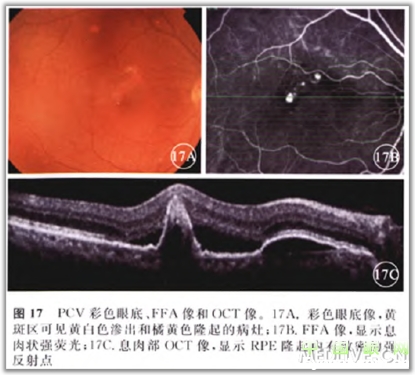 �ۿ�̩�����������OCT���ͼ��ɼ�������������ǳ�ֵ���ղأ�