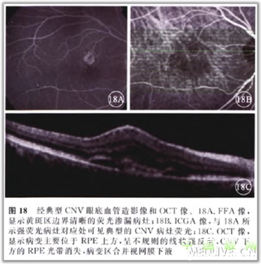 �ۿ�̩�����������OCT���ͼ��ɼ�������������ǳ�ֵ���ղأ�